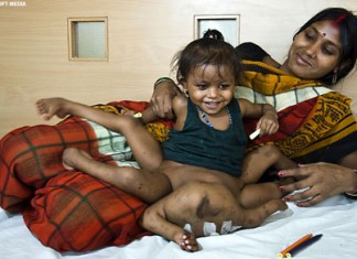 Vishnu Baby Goes Under the Knife