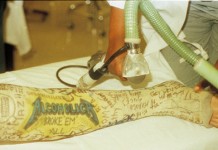 Harald Oimoen’s Shattered Leg in the Front Row